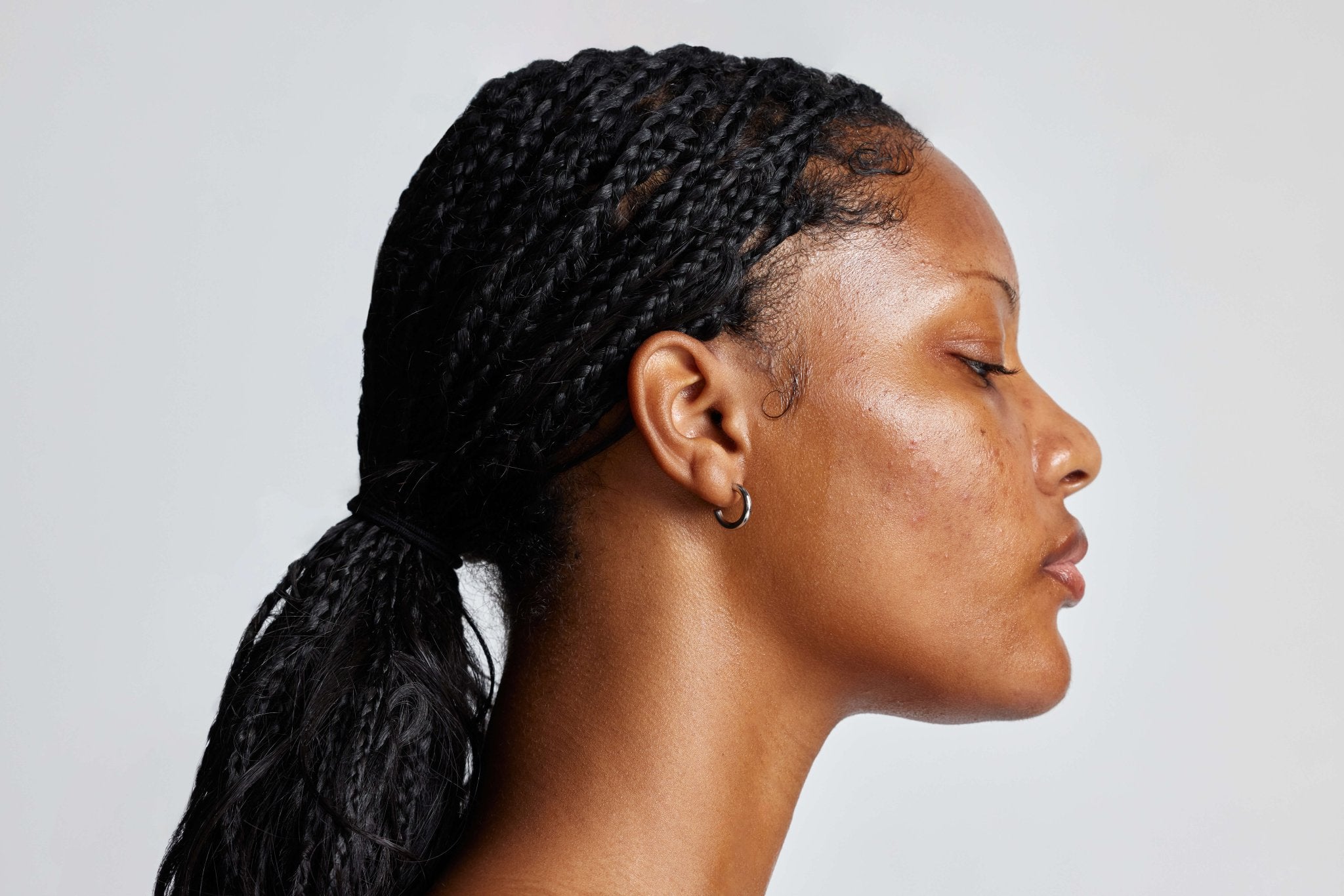 Sebum Reduction Image